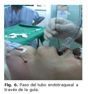 f0610114